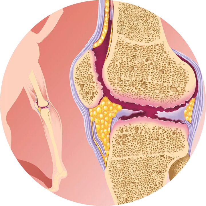 Hondroten - Podržava pokretljivost zglobova