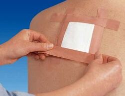 Korištenje terapeutskog flastera za bolove u leđima